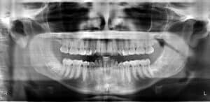 iCAT Rehil Orthodontics in Woodland Hills, CA