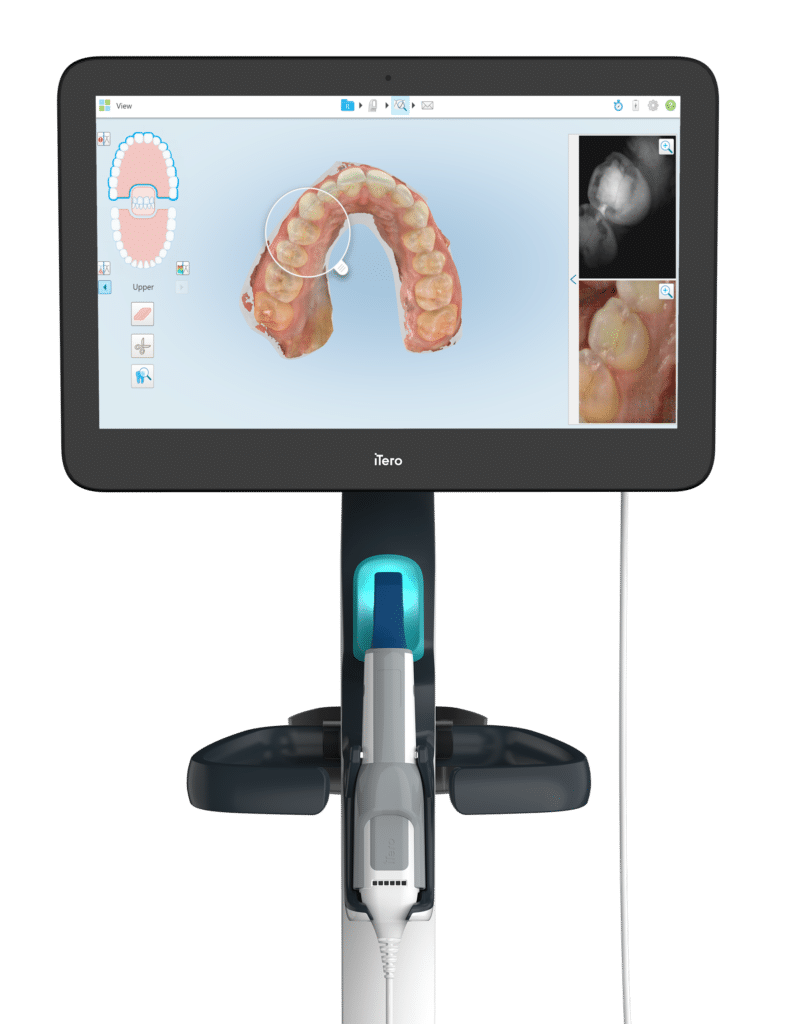 itero Rehil Orthodontics in Woodland Hills, CA